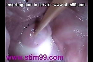 Stick give semen cum give cervix wide dilatation fur pie speculum